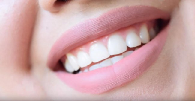 Безопасное отбеливание зубов в домашних условиях