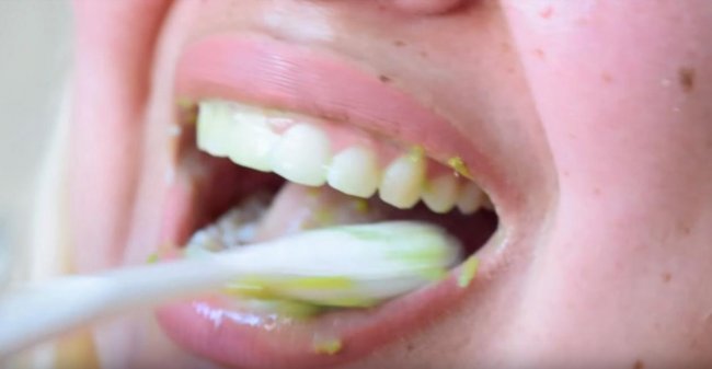 Безопасное отбеливание зубов в домашних условиях